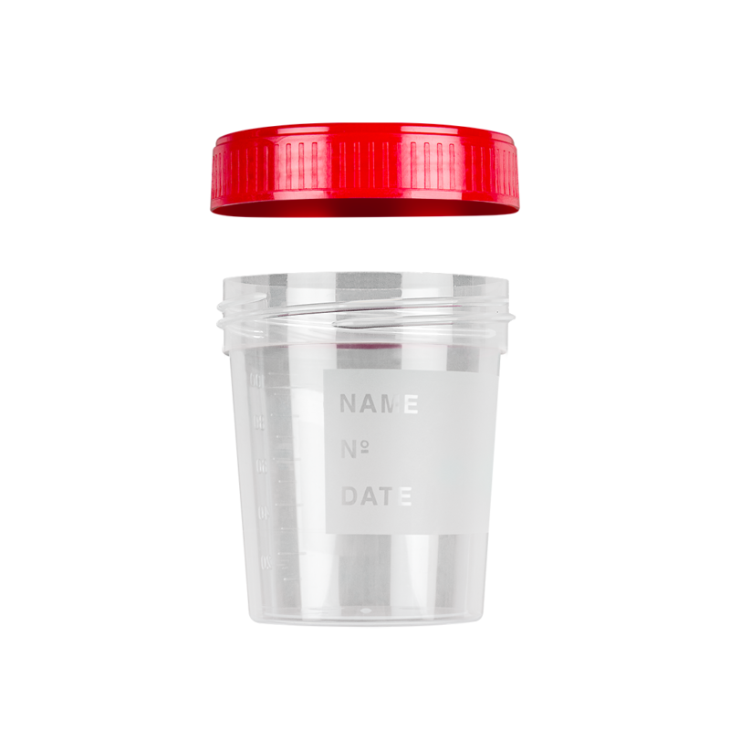 urine container with frosted label with screw cap apart