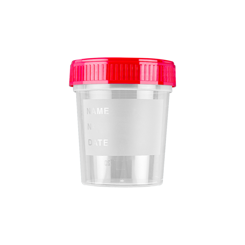 urine container with writing surface with screw cap