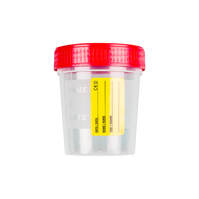 urine container with paper label with screw cap