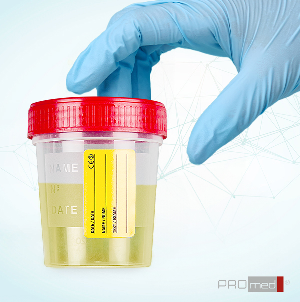 urintainer® 120ml: affidabilità, sicurezza e praticità nella raccolta dei campioni biologici